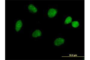 Immunofluorescence of purified MaxPab antibody to FLJ13798 on HeLa cell. (JMJD5 anticorps  (AA 1-416))