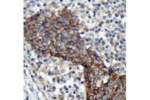 IHC analysis of EGFR using anti-EGFR antibody (ABIN7601478).
