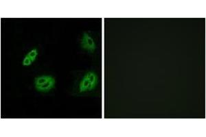 Immunofluorescence analysis of A549 cells, using OR4B1 Antibody. (Olfactory Receptor 4B1 (OR4B1) (AA 260-309) anticorps)