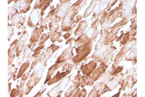Formalin-fixed, paraffin-embedded human Cardiac Muscle stained with Sarcomeric Actinin Alpha 2 Mouse Monoclonal Antibody (ACTN2/3294).
