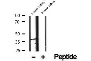 Western blot analysis of extracts of human kidney tissue, using DYNC2LI1 antibody.