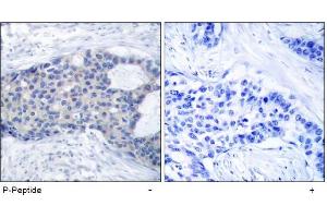 Image no. 1 for anti-zeta-Chain (TCR) Associated Protein Kinase 70kDa (ZAP70) (pTyr493) antibody (ABIN196887) (ZAP70 anticorps  (pTyr493))