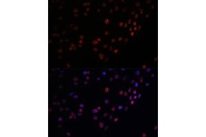 Immunofluorescence analysis of C6 cells using Matrin 3 antibody (ABIN7268415) at dilution of 1:100. (MATR3 anticorps  (AA 747-847))
