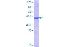 Image no. 1 for Ubiquitin Specific Peptidase 7 (Herpes Virus-Associated) (USP7) (AA 13-110) protein (GST tag) (ABIN1324846)