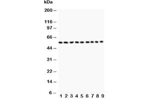 Western blot testing of Desmin antibody and Lane 1:  (rat) skeletal muscle;  2: (r) heart;  3: (mouse) skeletal muscle;  4: (m) heart;  5: (h) HeLa;  6: (h) HT1080;  7: (h) COLO320;  8: (h) HEPA;  9: (m) NIH3T3 (Desmin anticorps  (AA 1-304))
