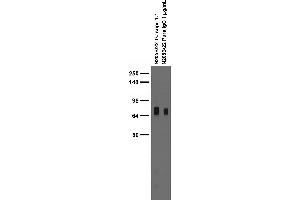 Adult rat brain membrane immunoblot.