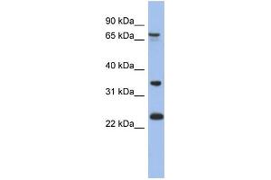WB Suggested Anti-TBC1D25 Antibody Titration: 0. (TBC1D25 anticorps  (N-Term))