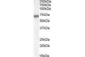 ABIN2560879 (0. (ABCD4 anticorps  (Internal Region))