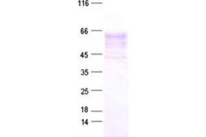 Validation with Western Blot