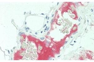 Detection of C5a in Human Small Intestine Tissue using Monoclonal Antibody to Complement Component 5a (C5a)