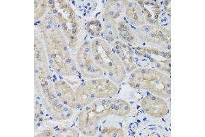 Immunohistochemistry of paraffin-embedded rat kidney using STK3 antibody. (STK3 anticorps  (AA 323-450))