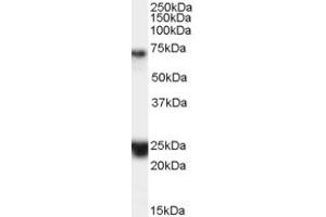 Western Blotting (WB) image for anti-Huntingtin Associated Protein 1 (HAP1) (AA 469-480) antibody (ABIN1493881)