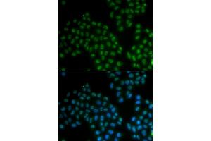 Immunofluorescence analysis of A549 cells using SOX2 antibody (ABIN5970209). (SOX2 anticorps)