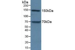 Figure. (APOB anticorps  (AA 3365-3548))