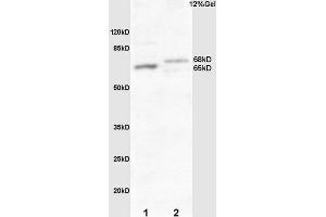 L1 mouse embryo lysate L2 human colon carcinoma lysates probed with Rabbit Anti-Frizzled 10/CD350 Polyclonal Antibody, Unconjugated  at 1:3000 for 90 min at 37˚C. (FZD10 anticorps  (AA 101-200))