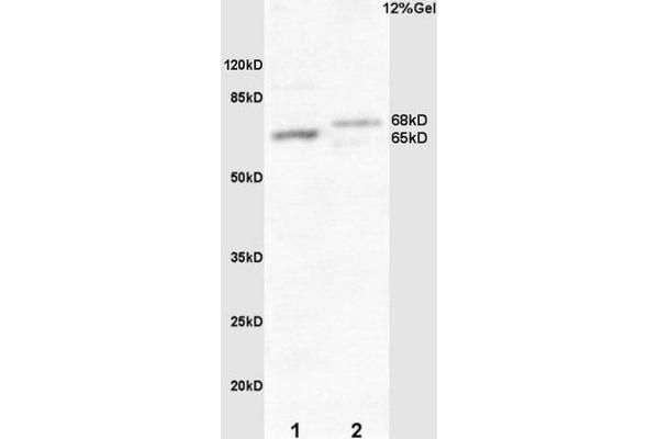 FZD10 anticorps  (AA 101-200)