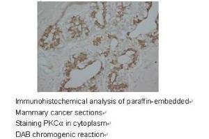 Staining with PRKCA antibody (PKC alpha anticorps  (C-Term))