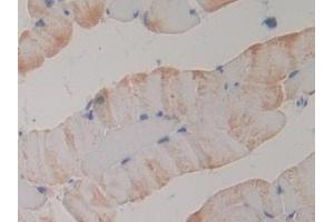 Detection of PLA2R1 in Mouse Skeletal muscle Tissue using Polyclonal Antibody to Phospholipase A2 Receptor 1 (PLA2R1) (PLA2R1 anticorps  (AA 1418-1487))