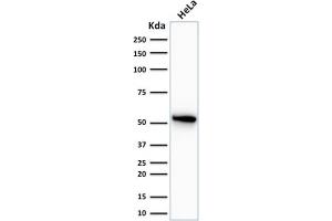 Western Blot Analysis of human HeLa cell lysate using Cytokeratin 7 Mouse Monoclonal Antibody (OV-TL12/30). (Cytokeratin 7 anticorps)