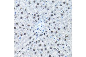 Immunohistochemistry of paraffin-embedded rat liver using SNRP Rabbit pAb (2161) at dilution of 1:200 (40x lens). (SNRPA1 anticorps  (AA 1-220))