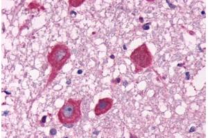 Anti-GPR40 antibody  ABIN1048820 IHC staining of human brain, neurons. (FFAR1 anticorps  (C-Term))