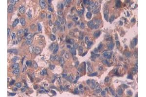 Used in DAB staining on fromalin fixed paraffin- embedded stomach cancer tissue (IL-24 anticorps  (AA 51-206))