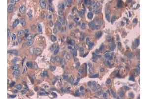 Used in DAB staining on fromalin fixed paraffin- embedded stomach cancer tissue (IL-24 anticorps  (AA 51-206))