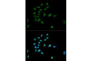 Immunofluorescence analysis of U2OS cells using PSMA1 antibody (ABIN5971354) at dilution of 1/100. (PSMA1 anticorps)