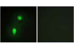 Immunofluorescence analysis of HuvEc cells, using hnRNP C1/C2 Antibody. (HNRNPC anticorps  (AA 241-290))