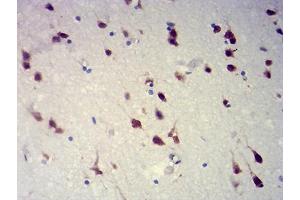 Immunohistochemical analysis of paraffin-embedded brain tissues using RBFOX2 mouse mAb with DAB staining.