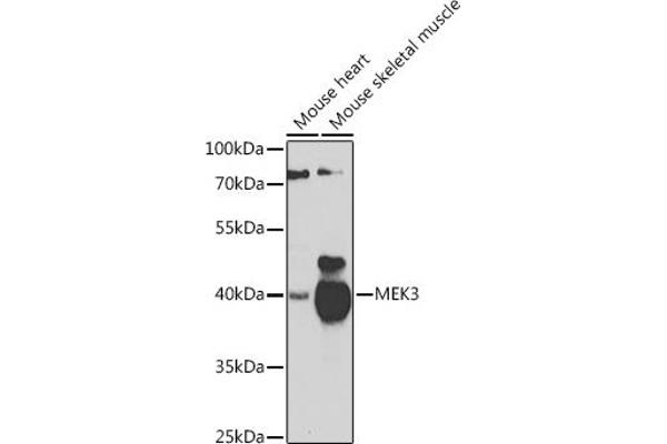 MAP2K3 anticorps  (AA 1-170)