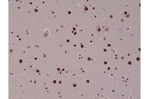 anti-5-Hydroxymethylcytosine (5-hmC) antibody