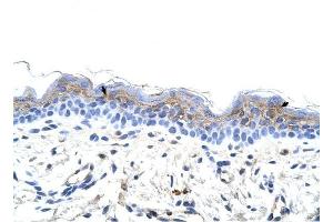 IRX3 antibody was used for immunohistochemistry at a concentration of 4-8 ug/ml to stain Squamous epithelial cells (arrows) in Human Skin. (IRX3 anticorps  (C-Term))