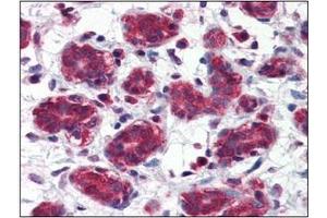 Immunohistochemistry (IHC) image for anti-Folate Hydrolase (Prostate-Specific Membrane Antigen) 1 (FOLH1) (AA 117-351) antibody (ABIN317554)