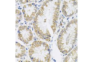 Immunohistochemistry of paraffin-embedded human stomach using IL13 antibody (ABIN3022881, ABIN3022882, ABIN3022883 and ABIN6219278) (40x lens). (IL-13 anticorps  (AA 25-146))