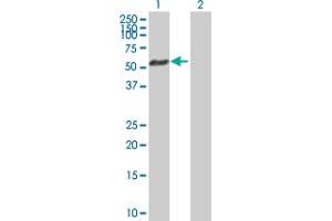 Western Blot analysis of AKT1 expression in transfected 293T cell line by AKT1 MaxPab polyclonal antibody. (AKT1 anticorps  (AA 1-480))