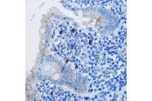 Immunohistochemistry of paraffin-embedded human appendix using IL8 Rabbit pAb (ABIN3016225, ABIN3016226, ABIN3016227 and ABIN6219634) at dilution of 1:100 (40x lens). (IL-8 anticorps  (AA 21-99))