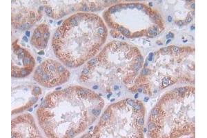 IHC-P analysis of Kidney tissue, with DAB staining. (IL-4 anticorps  (AA 25-153))