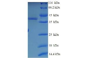 SDS-PAGE (SDS) image for Oligonucleotide/oligosaccharide-Binding Fold Containing 2A (OBFC2A) (AA 1-204), (full length) protein (His-SUMO Tag) (ABIN5711666)