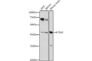 Western blot analysis of extracts of various cell lines, using HTR antibody (ABIN7267790) at 1:1000 dilution. (HTRA3 anticorps  (AA 334-453))