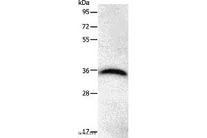 Western blot analysis of Hela cell, using PPP1CB Polyclonal Antibody at dilution of 1:450 (PPP1CB anticorps)
