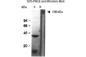 Western Blotting (WB) image for anti-Aggregation Factor antibody (ABIN191910) (Aggregation Factor anticorps)