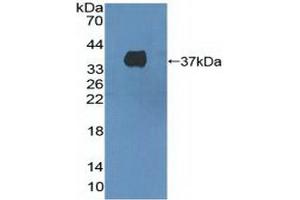 Detection of Recombinant HGFR, Human using Polyclonal Antibody to C-Met (MET)
