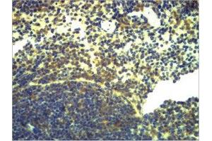 Immunohistochemical analysis of paraffin-embedded Mouse Spleen Tissue using TLR2 Polyclonal Antibody. (TLR2 anticorps)