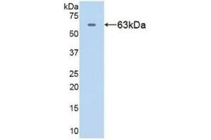 Detection of Recombinant HSPD1, Human using Polyclonal Antibody to Heat Shock Protein 60 (Hsp60)