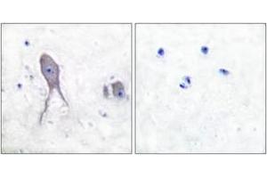 Immunohistochemistry analysis of paraffin-embedded human brain tissue, using Notch 2 (Cleaved-Asp1733) Antibody. (NOTCH2 anticorps  (Cleaved-Asp1733))