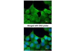ICC/IF Image Immunofluorescence analysis of paraformaldehyde-fixed A431, using EXOC7, antibody at 1:200 dilution.