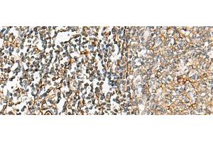 Immunohistochemistry of paraffin-embedded Human tonsil tissue using CHKA Polyclonal Antibody at dilution of 1:35(x200) (Choline Kinase alpha anticorps)