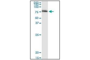 Western Blotting (WB) image for anti-Serpin Peptidase Inhibitor, Clade G (C1 Inhibitor), Member 1 (SERPING1) (AA 1-501) antibody (ABIN782340)