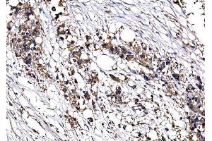 IHC analysis of IMPDH1 using anti-IMPDH1 antibody (ABIN7599864). (IMPDH1 anticorps  (AA 123-500))